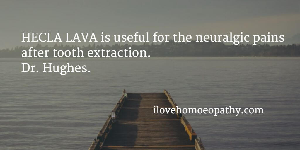 Neuralgia after tooth extraction >