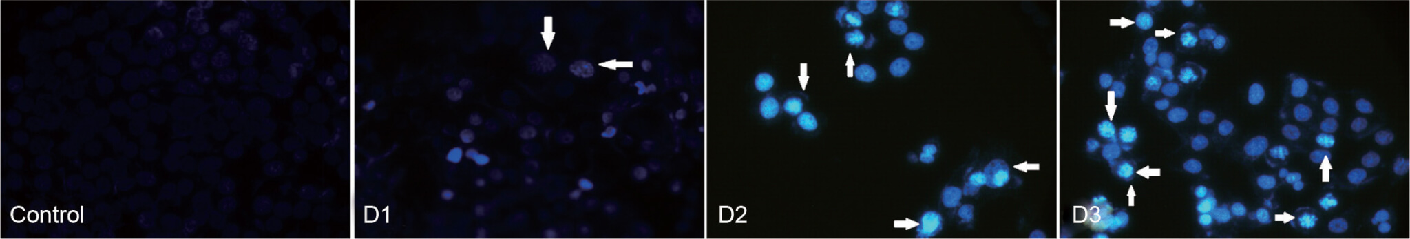 Homeopathic mother tincture of Phytolacca decandra induces apoptosis in skin melanoma cells by activating caspase-mediated signaling via reactive oxygen species elevation