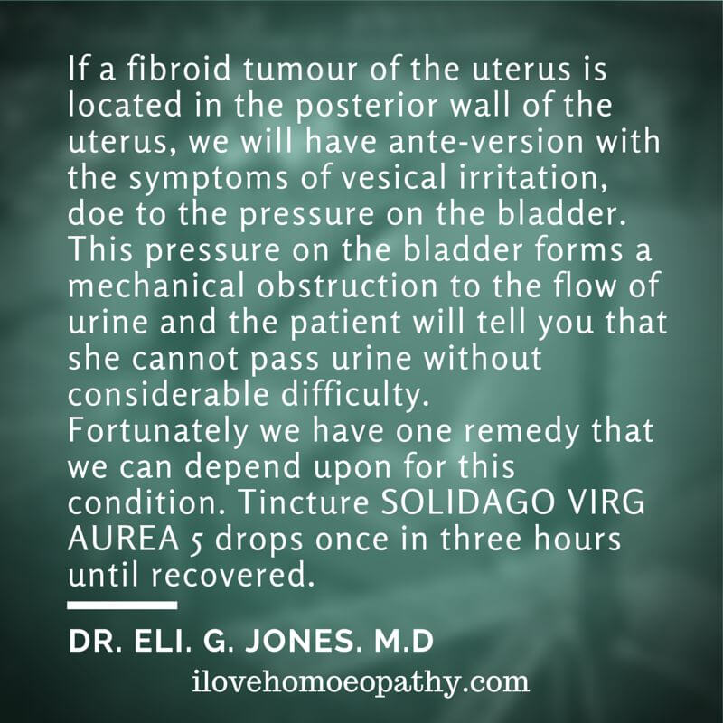 UTERINE FIBROIDS