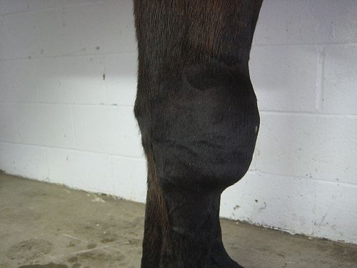 BURSITIS