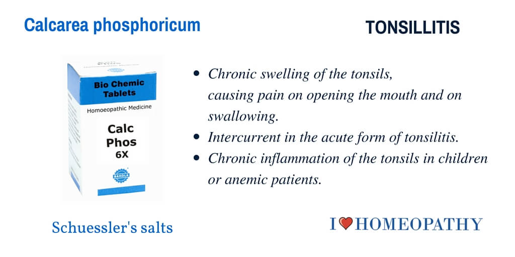TONSILLITIS