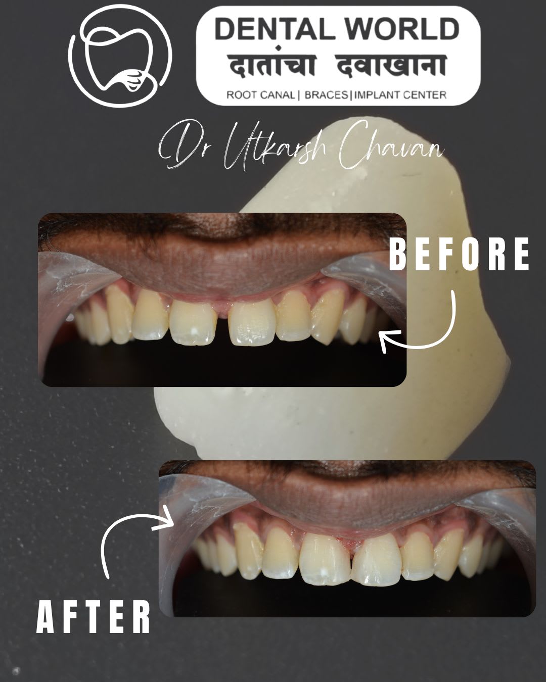 After Treatment — Clinical Photos
