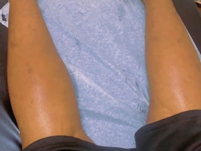 Back, Legs & Arms Waxing