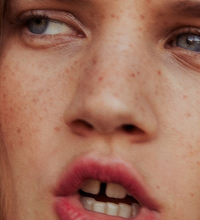 the-skin-youre-in-3.jpg