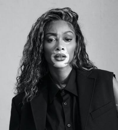 winnie-harlow-by-nikki-esser-1.jpg