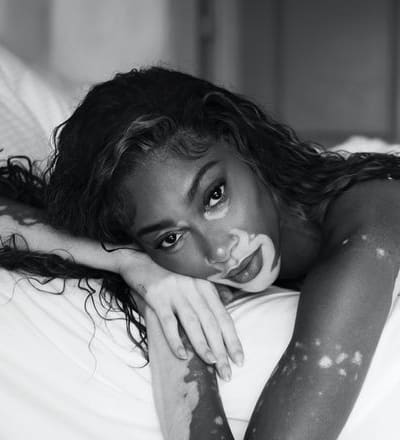winnie-harlow-by-nikki-esser-2.jpg