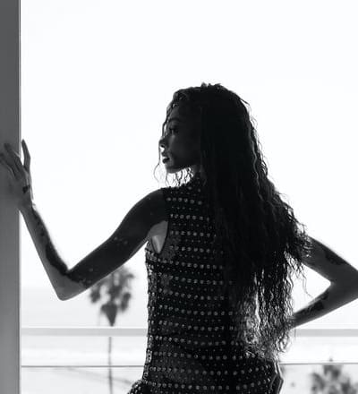 winnie-harlow-by-nikki-esser-5.jpg