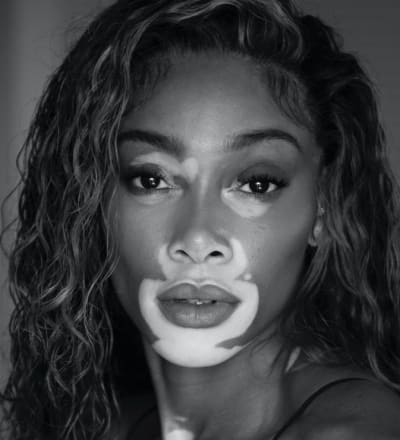 winnie-harlow-by-nikki-esser-8.jpg