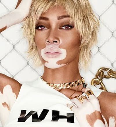 winnie-harlow-x-steve-madden-5.jpg