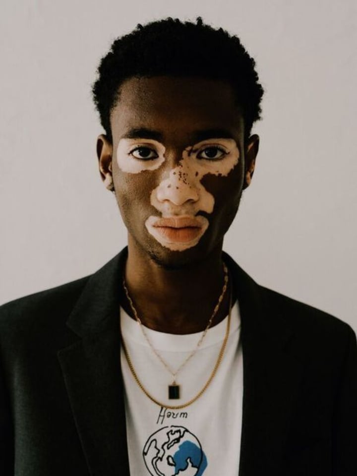 Yvesmark Chery — portrait