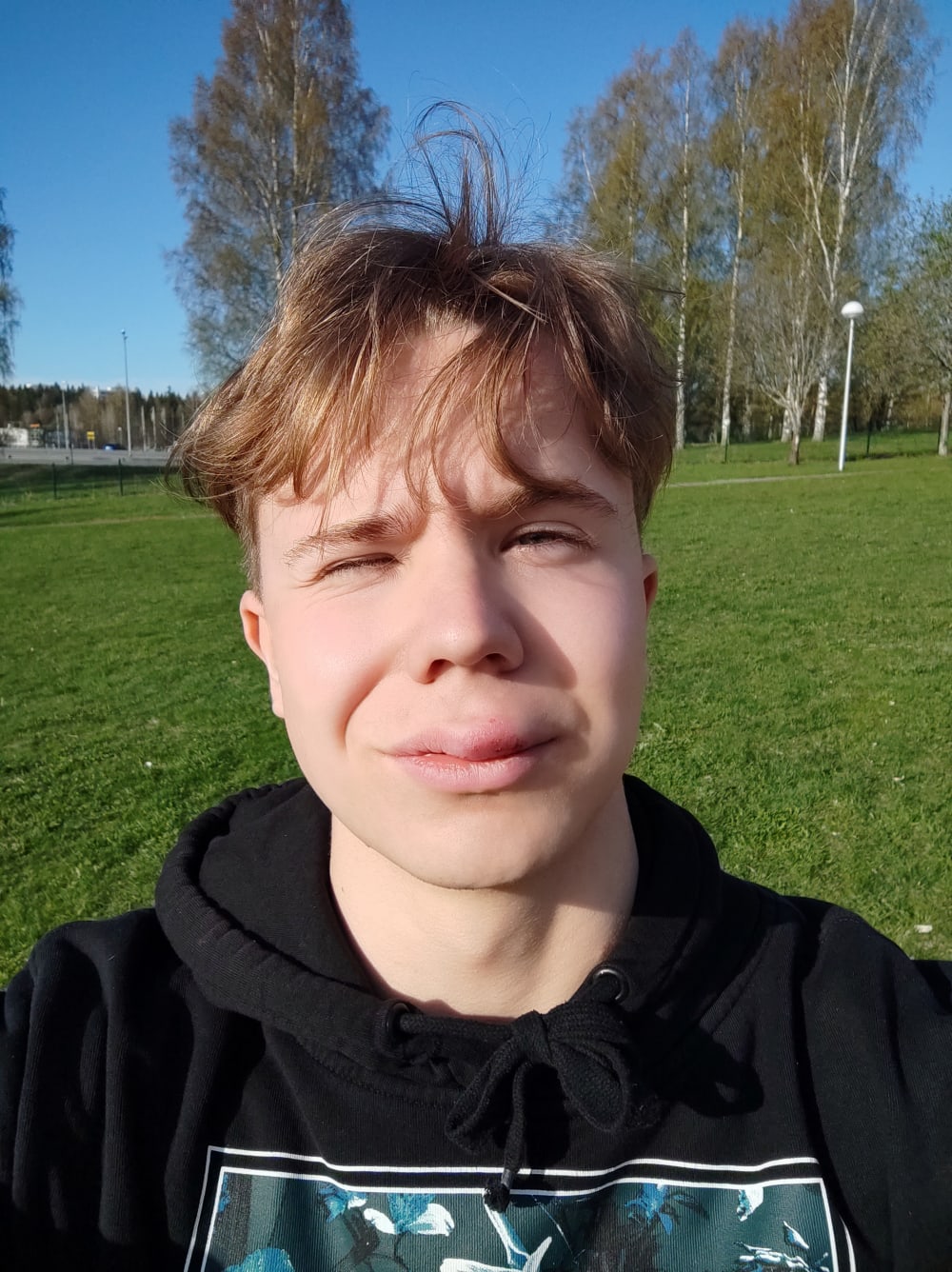 got hit in the face with a baseball, lip completely blown