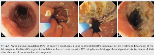 Clinical endoscopic image