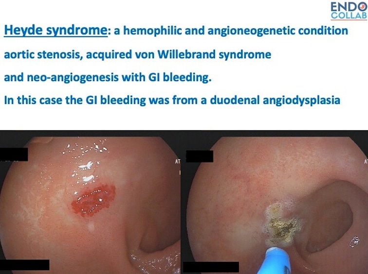Clinical endoscopic image