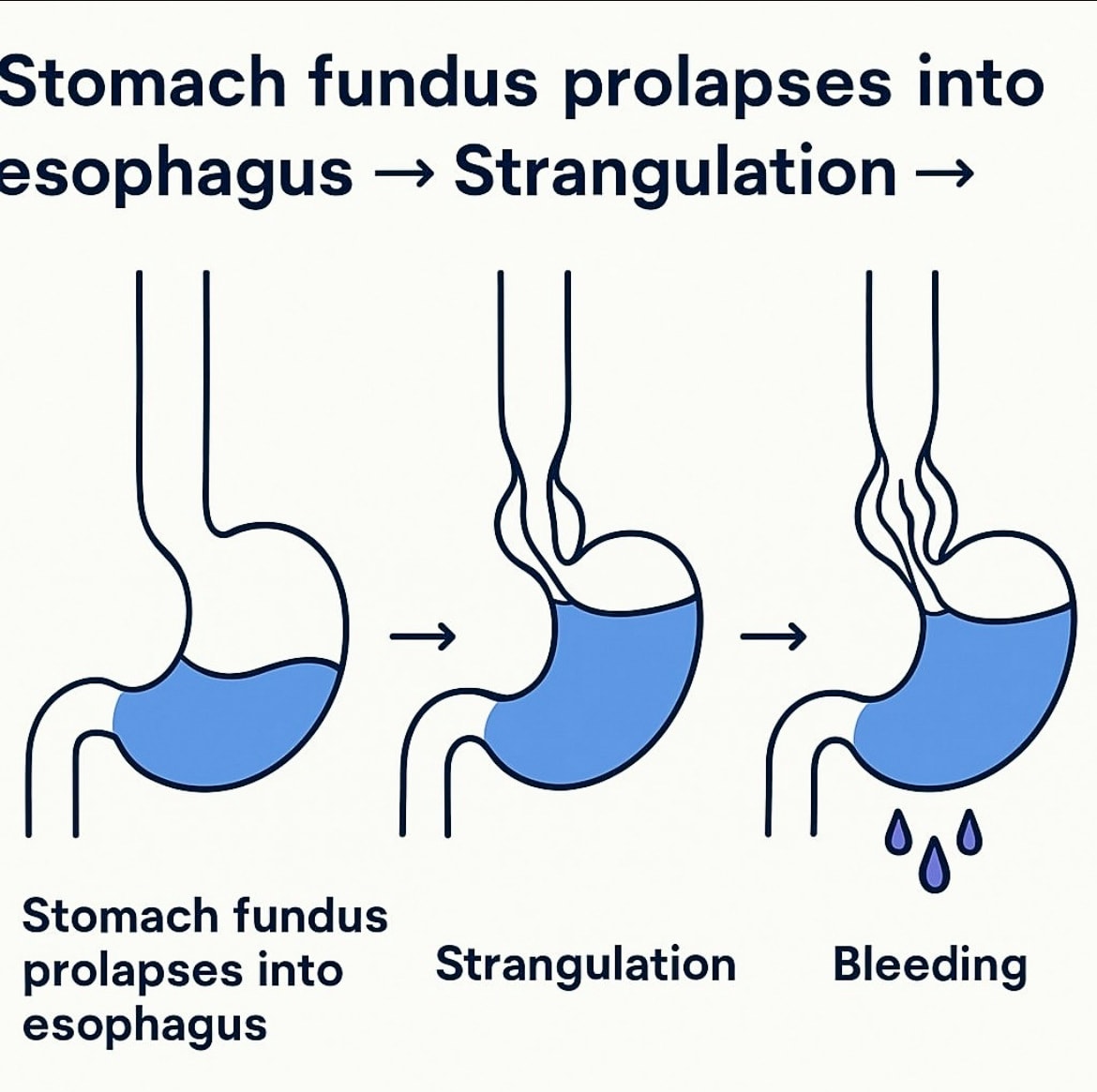 Clinical endoscopic image