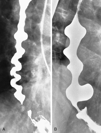 Clinical endoscopic image