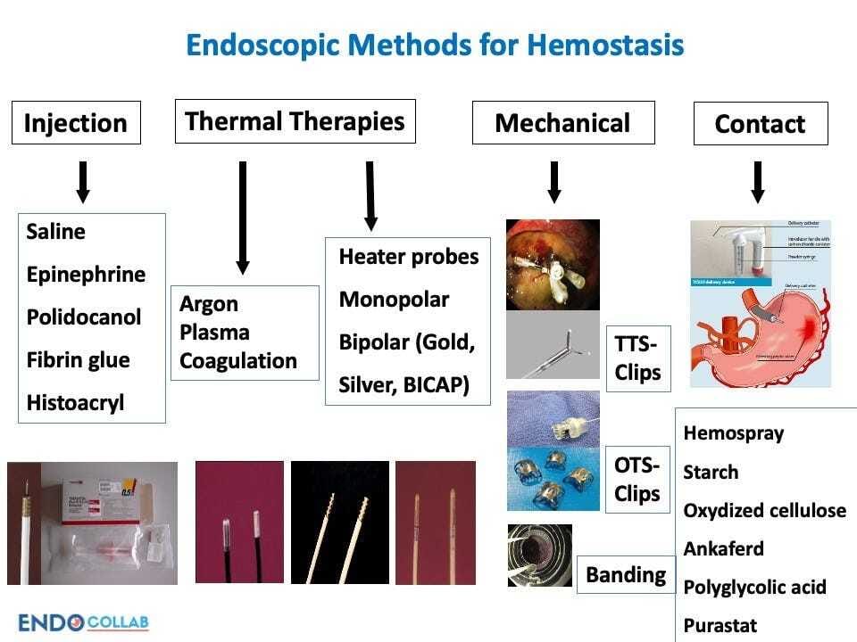 A diagram of different types of hemostasis Description automatically generated
