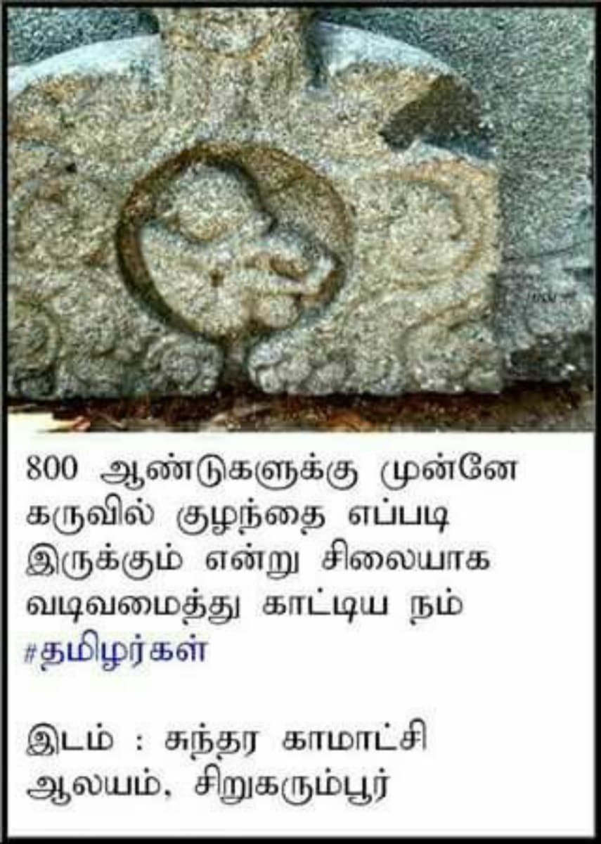 Vel Vinthanu Uyiranu Murukan Vel Sperms Murugan | வேல் விந்தணு உயிரணு முருகன் Vel Sperms Murugan