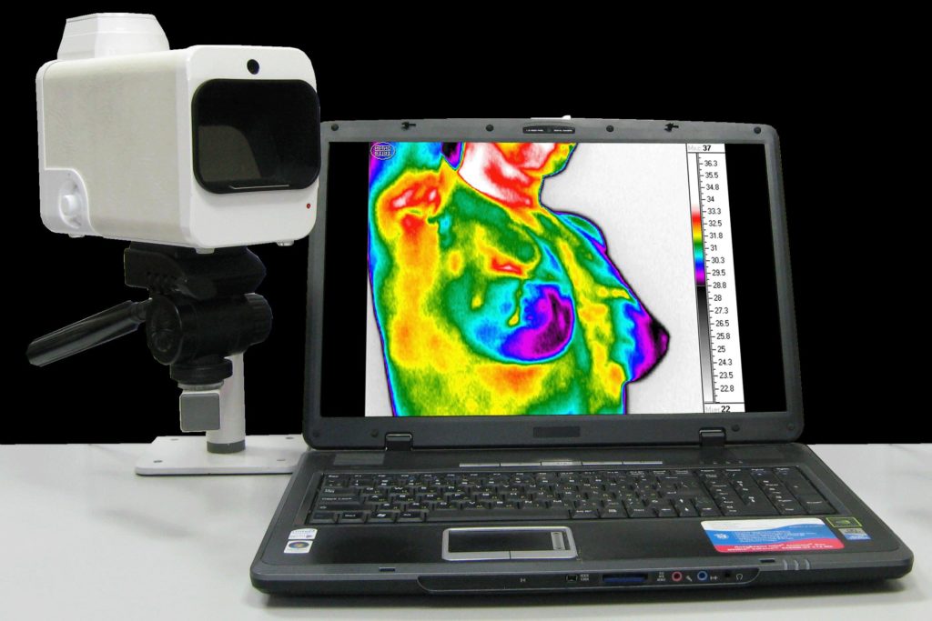 Медицинская термография презентация