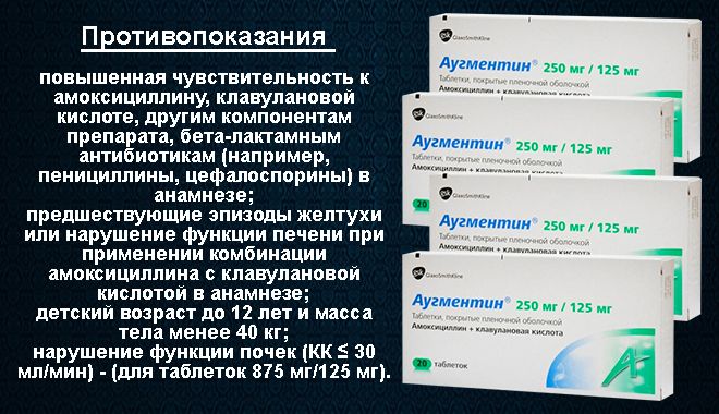 Антибиотики при воспалении у женщин. Антибиотик от цистита дешевый. Антибиотик цистит у женщин. Антибиотики от цистита у женщин список. Антибиотики при цистите у женщин.