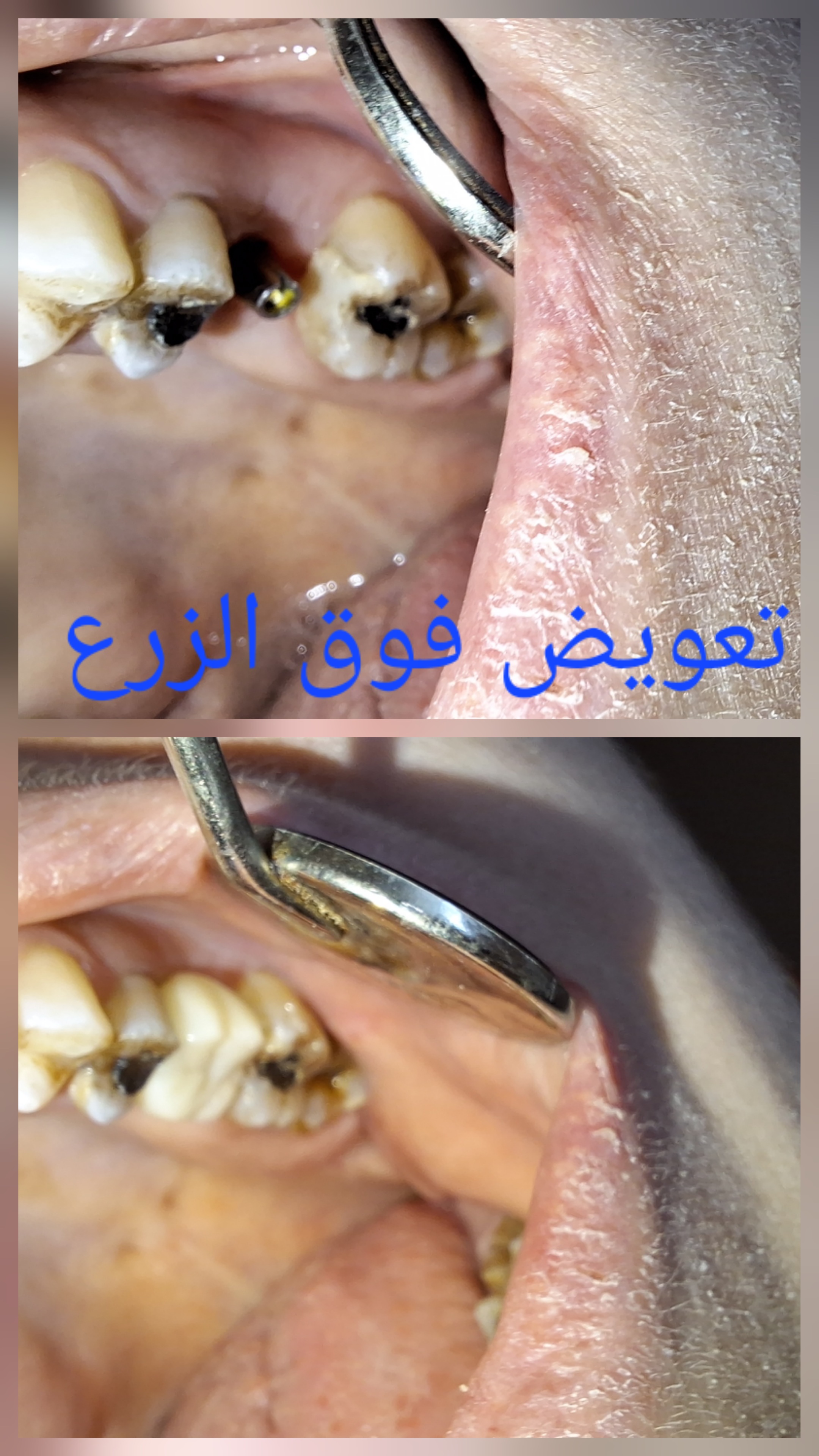صورة 4