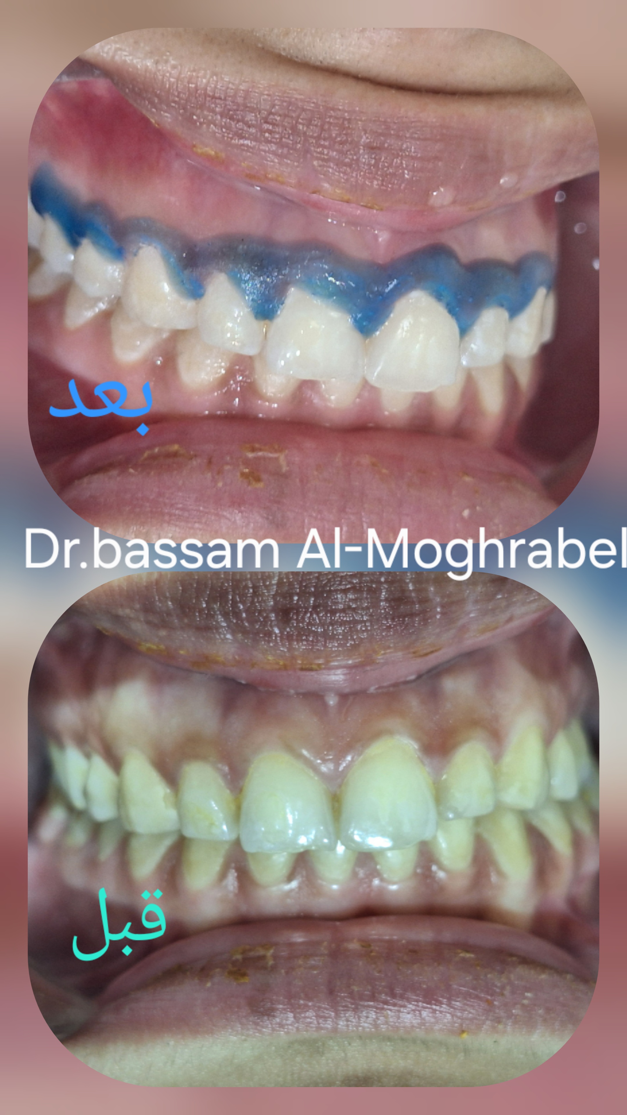 صورة 5