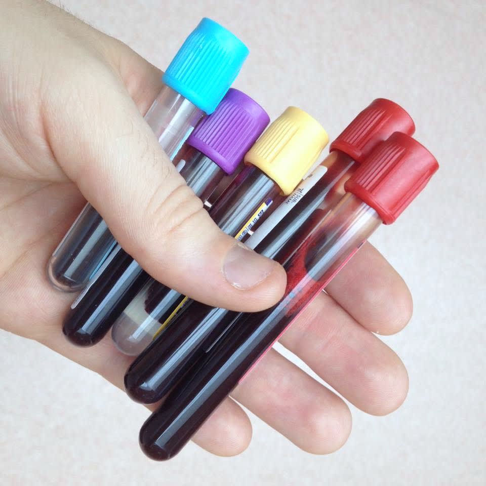 Clinical blood collection tubes in a veterinary emergency setting