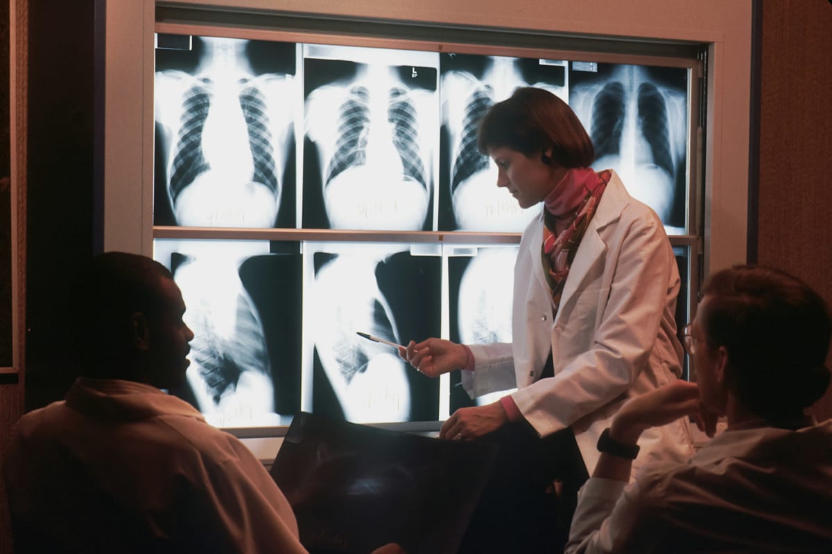Radiologists reviewing chest X-rays on a lightbox — illustrating the collaborative imaging-review work that internationally trained radiographers join after MRPBA registration in Australia