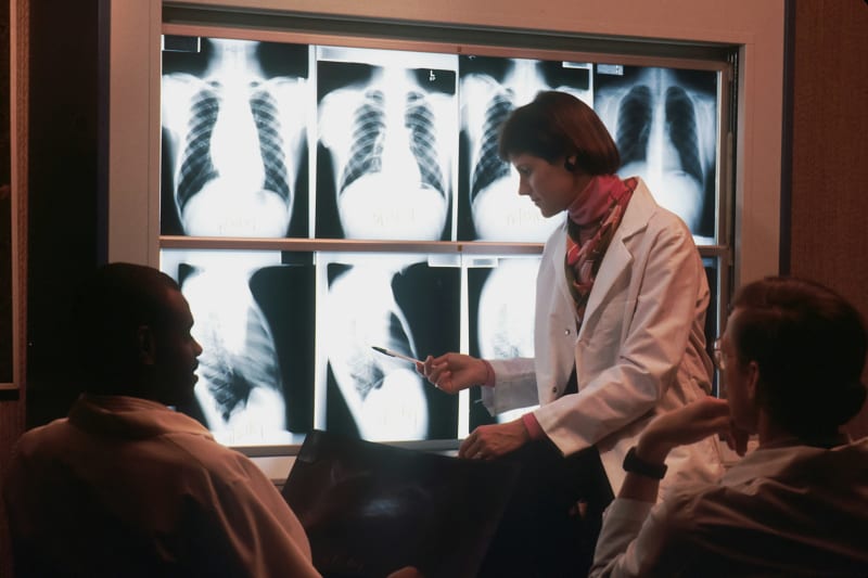 Radiologists reviewing chest X-rays on a lightbox — illustrating the collaborative imaging-review work that internationally trained radiographers join after MRPBA registration in Australia