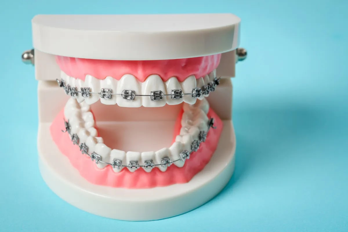 Maintaining Your Braces: A Plano Teen's Guide, Plano, TX A selection of interdental brushes, water flosser, and mouthwash.