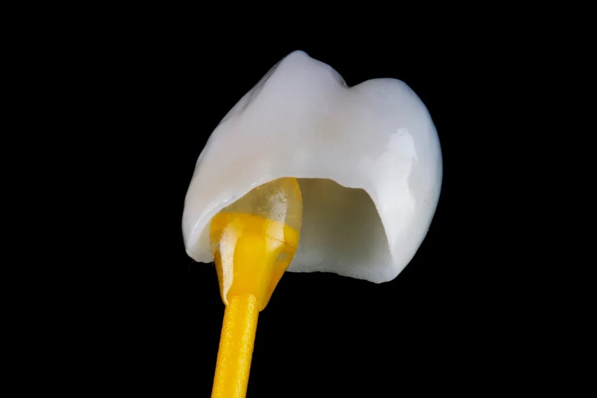 Crowns in Plano: Restoring Your Smile on W Spring Creek Pkwy, Plano, TX Dental crown placement