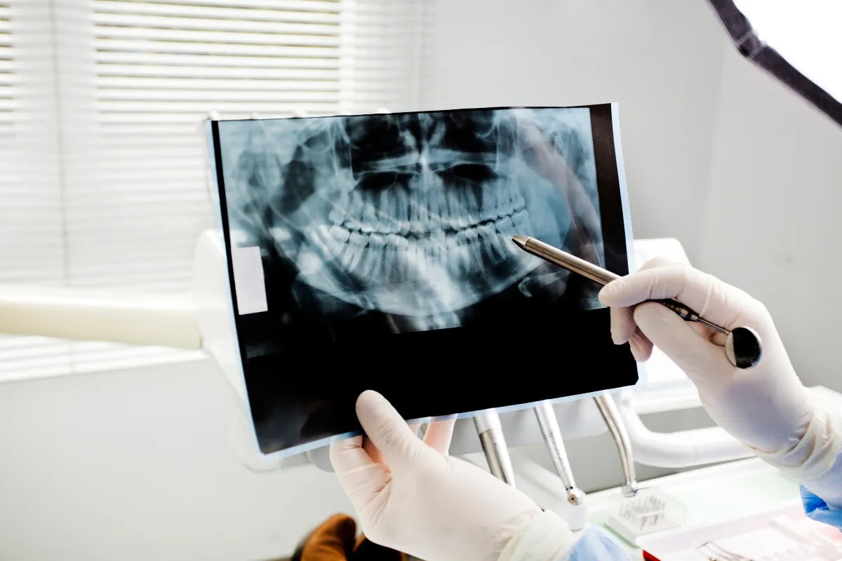 The Importance of Exam & X-rays for Dental Health in Plano, Plano, TX Dental X-rays