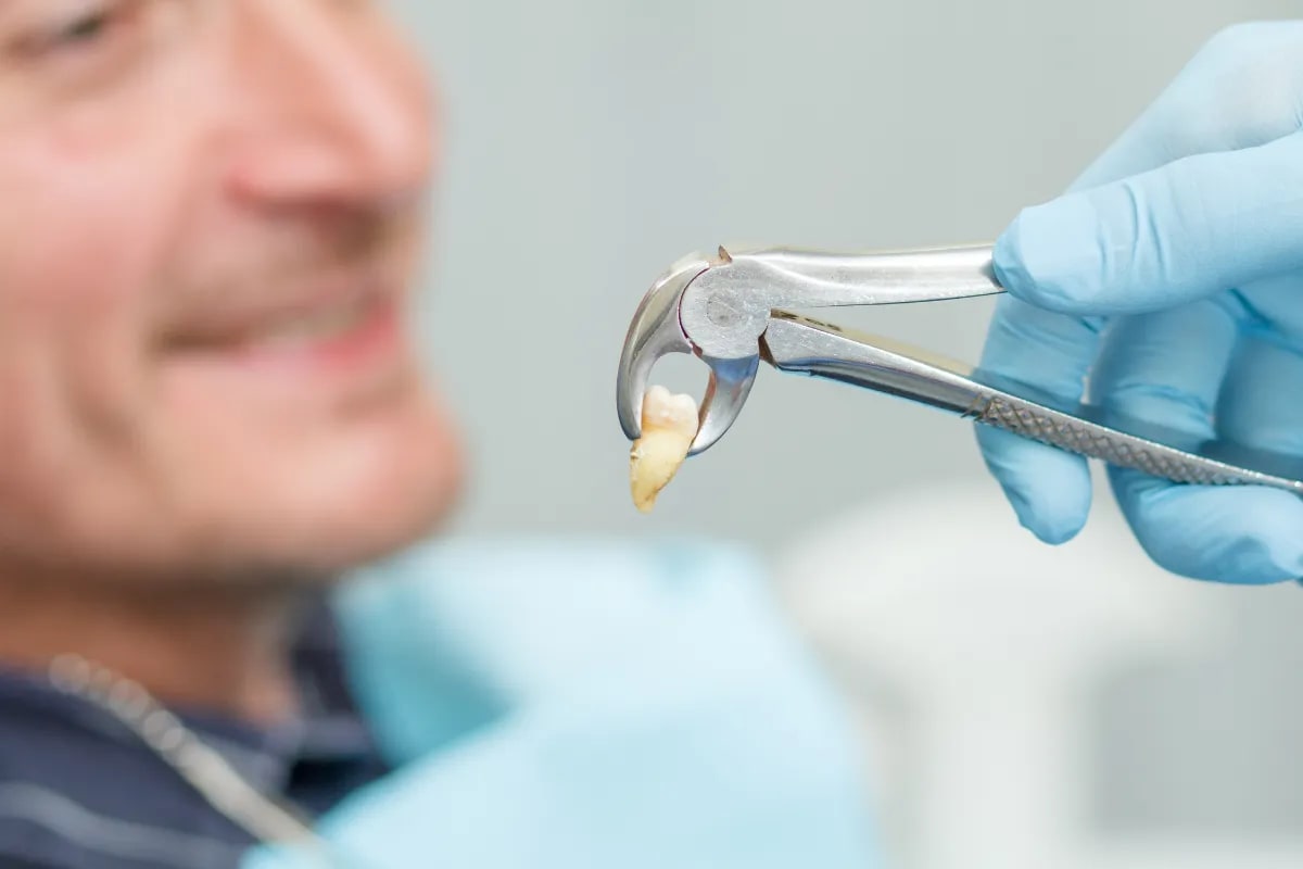 Preparing for Wisdom Teeth Removal: A Plano Guide Near 75023, Plano, TX Person using ice pack on jaw after surgery