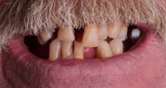 OMS-Dental-Before-After-4.png OMS-Dental-Before-After-4.png