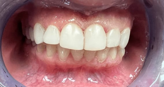 OMS-Dental-Before-After-1.png OMS-Dental-Before-After-1.png