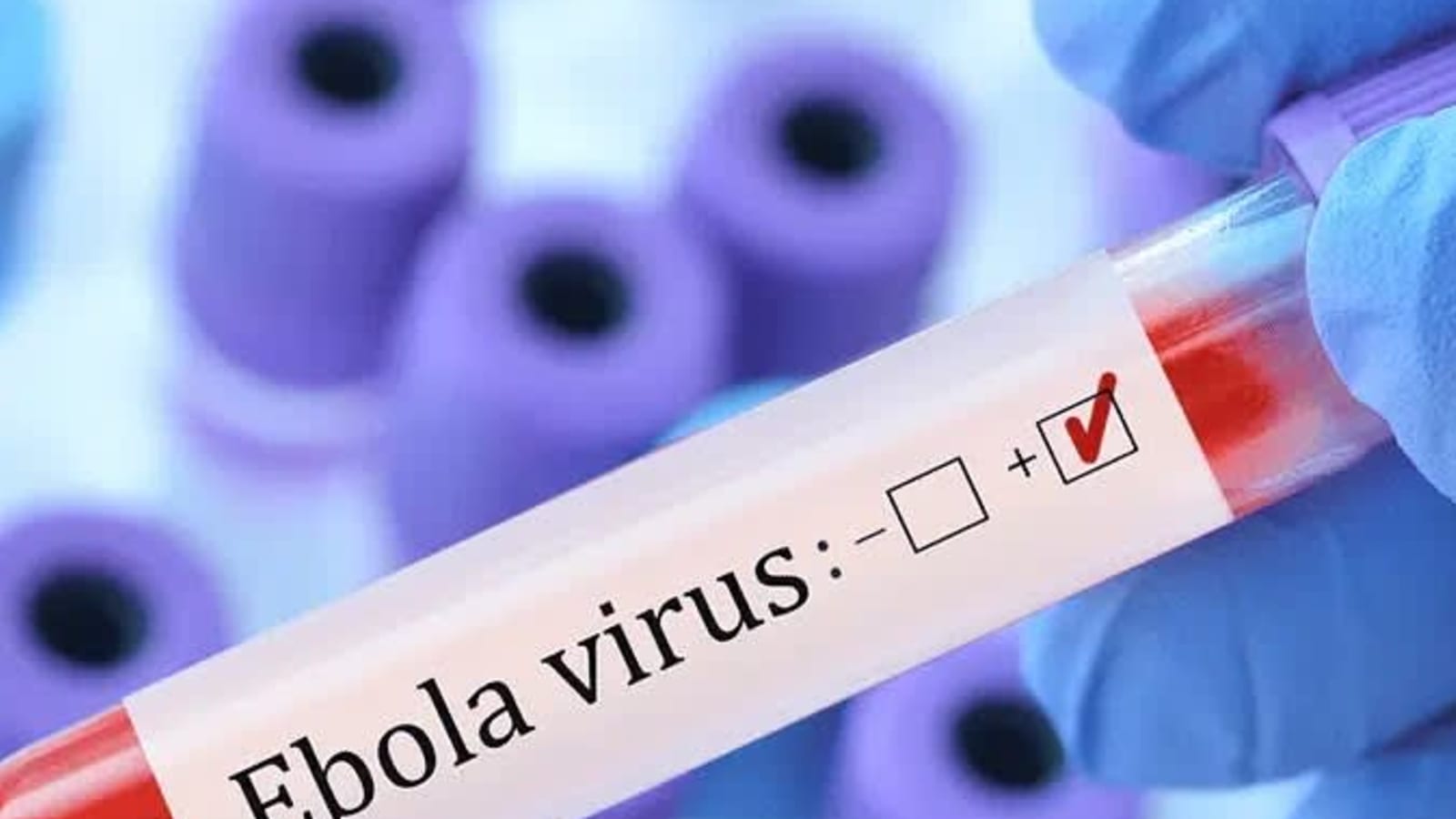 Nigeria Confirms Ebola Case in Abuja as Health Authorities Trace 44 Contacts