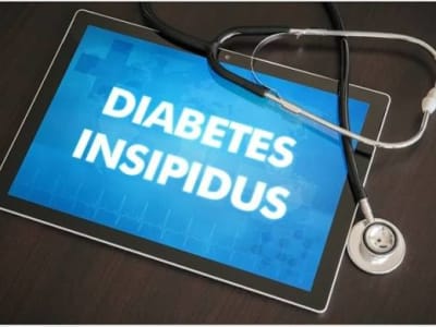 Diabetes Insipidus: Understanding Its Causes, Types, Symptoms, Diagnosis, Treatment, and Complications