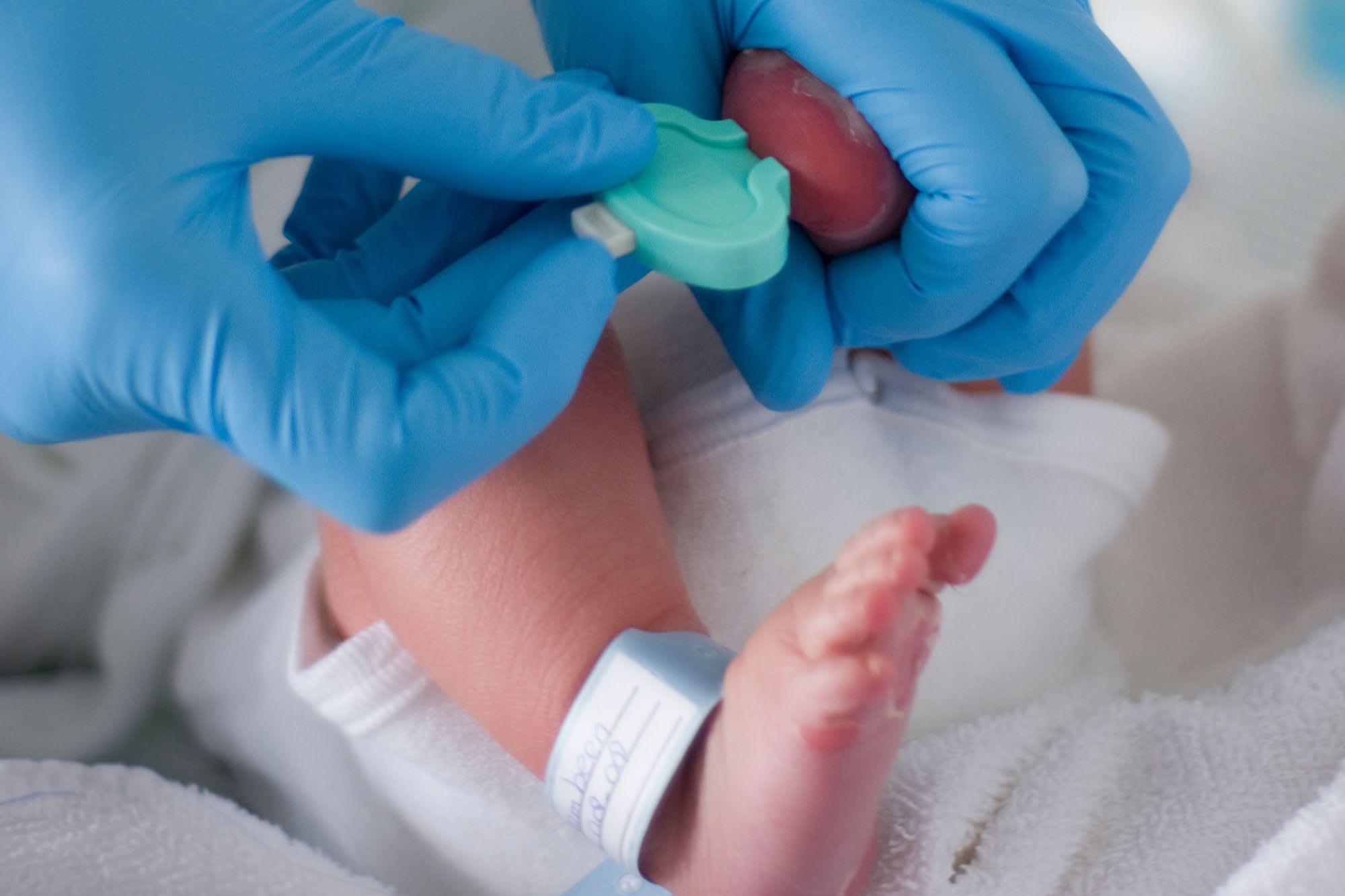 The Lifesaving Test Every Nigerian Baby Needs