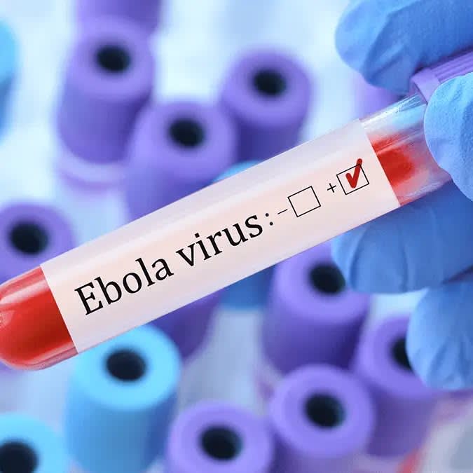 Nigeria Confirms Ebola Case in Abuja as Health Authorities Trace 44 Contacts