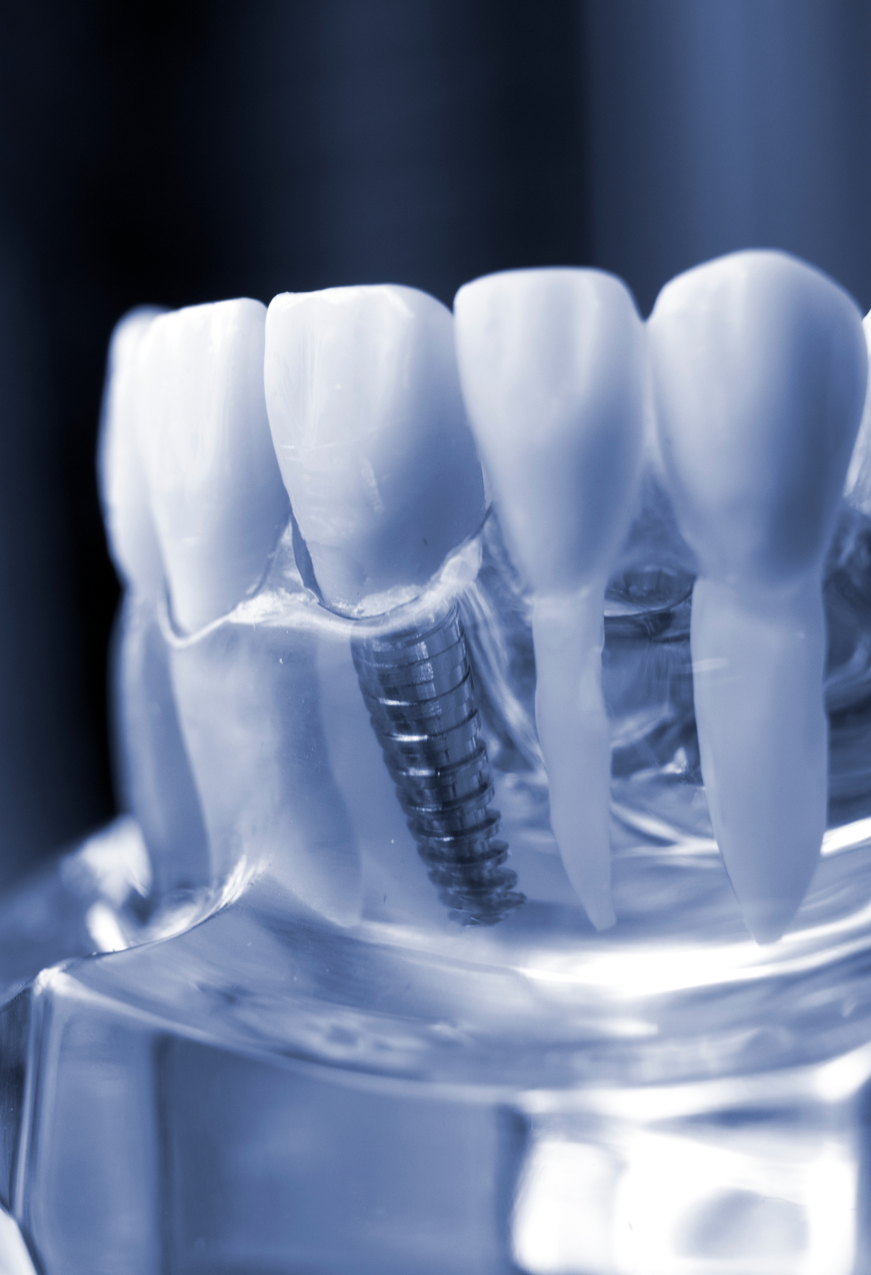 Dr. Alberto Guevara — Implantólogo Cancún
