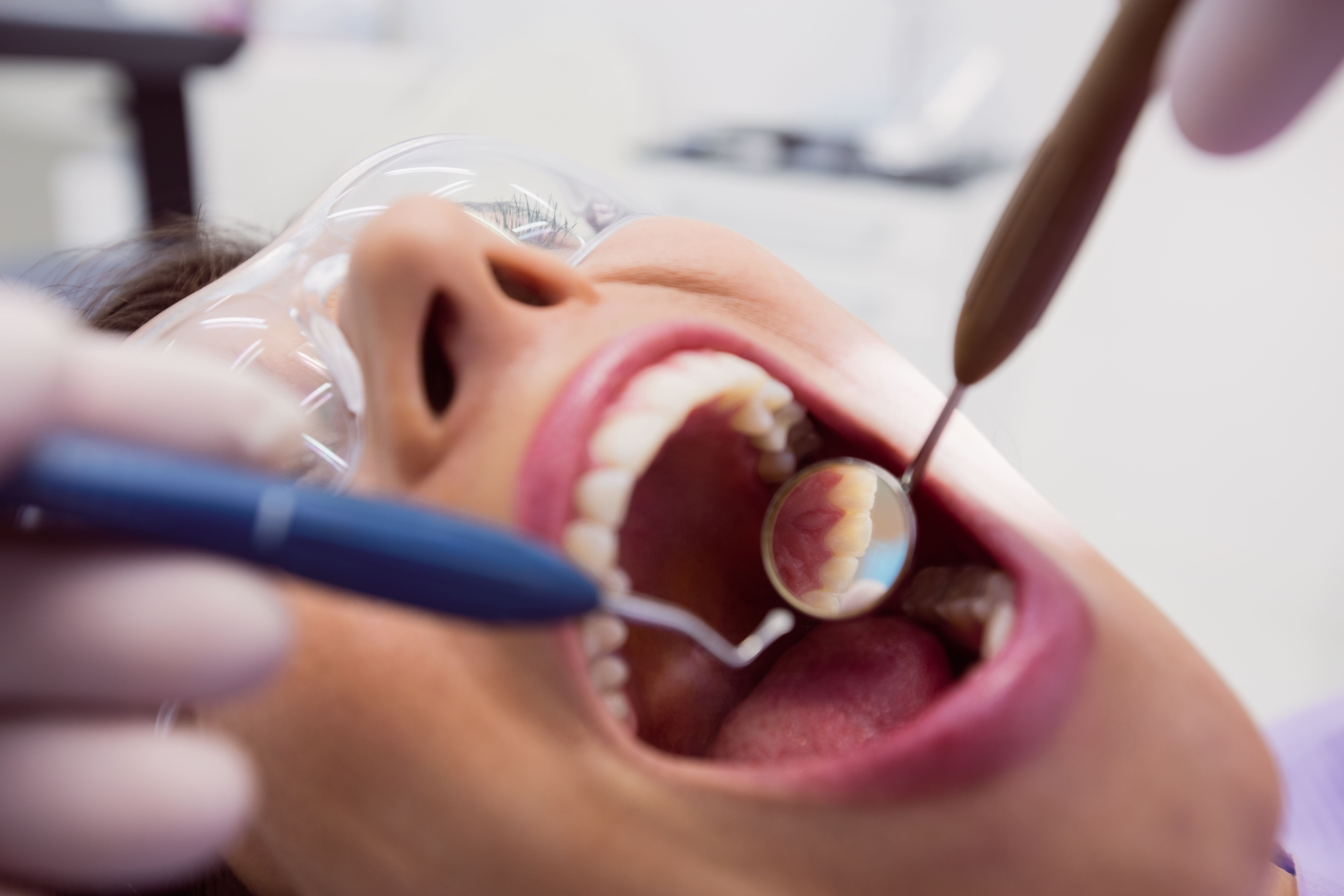 Mantenimiento periodontal
