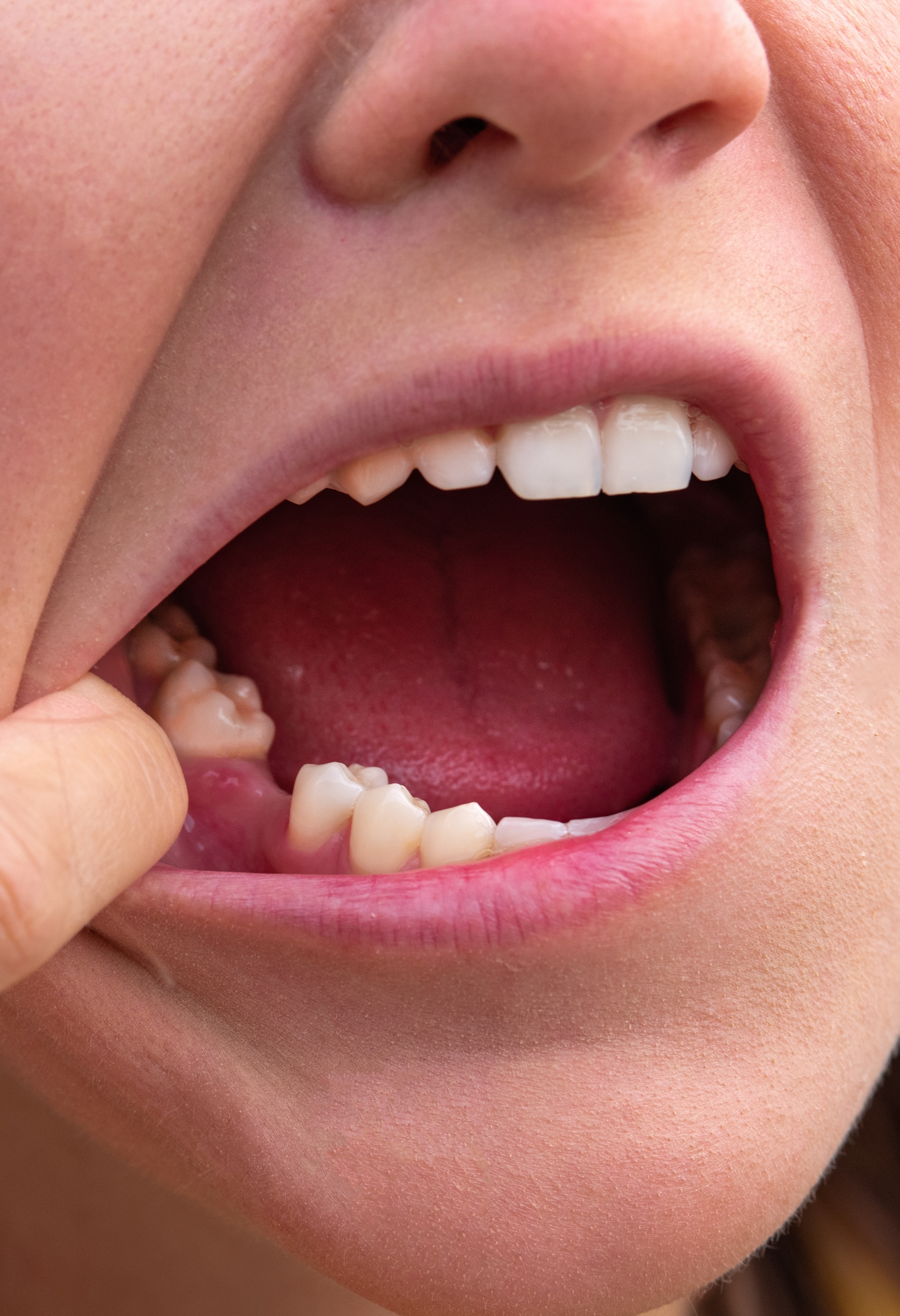 Urgencias dentales Dentavida Cancún