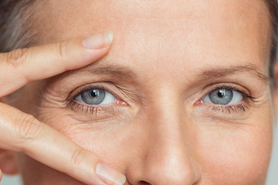 Cirug%C3%ADa de ptosis palpebral Cd. Ju%C3%A1rez fg1tpn