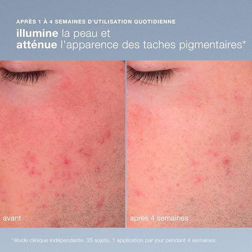 Vue 2 de Dermalogica Daily Microfoliant