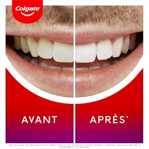 Vue 4 de Colgate Max White Ultimate