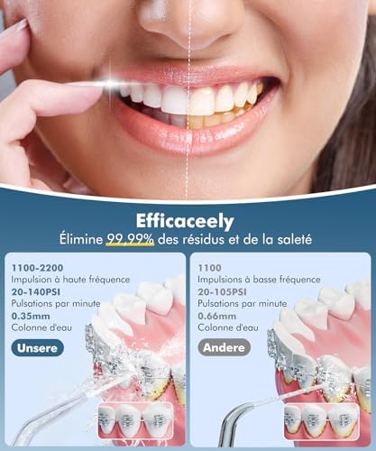 Vue 2 de Etrobot Jet Dentaire Hydropulseur