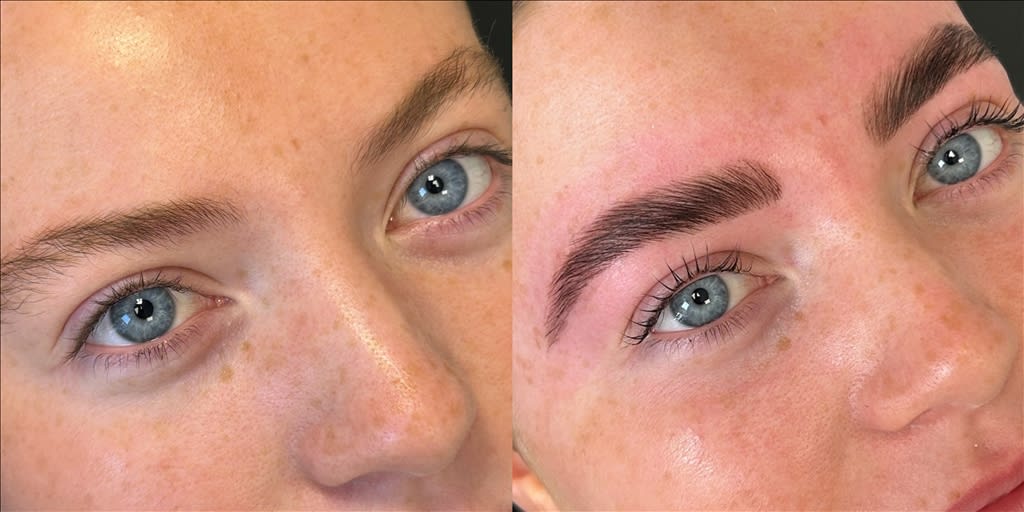 Brow Lamination