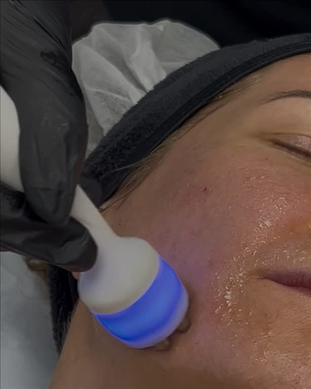 3D-HydrO2 Facial