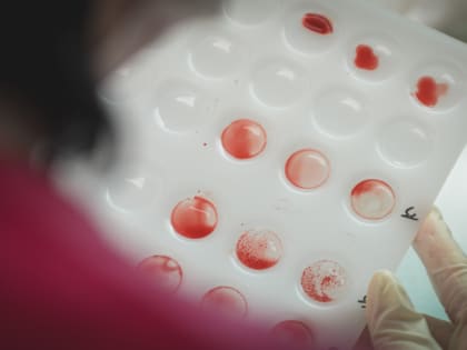 Живут до 6 лет: врач из Уфы перечислила семь признаков наличия червей внутри человека