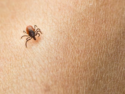 В Башкирии за неделю клещи покусали 106 человек