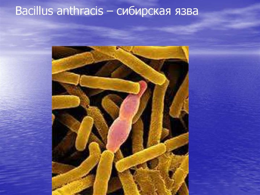 Возбудитель сибирской язвы. Bacillus anthracis, а22 (Сибирская язва). Возбудитель - Bacillus anthracis. Бацилла антрацис Сибирская язва.